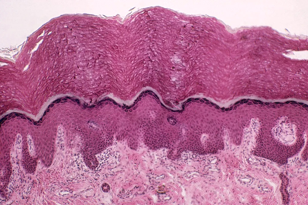 New discoveries in medicine via NT Times show the Interstitium as a major connective network in our bodies